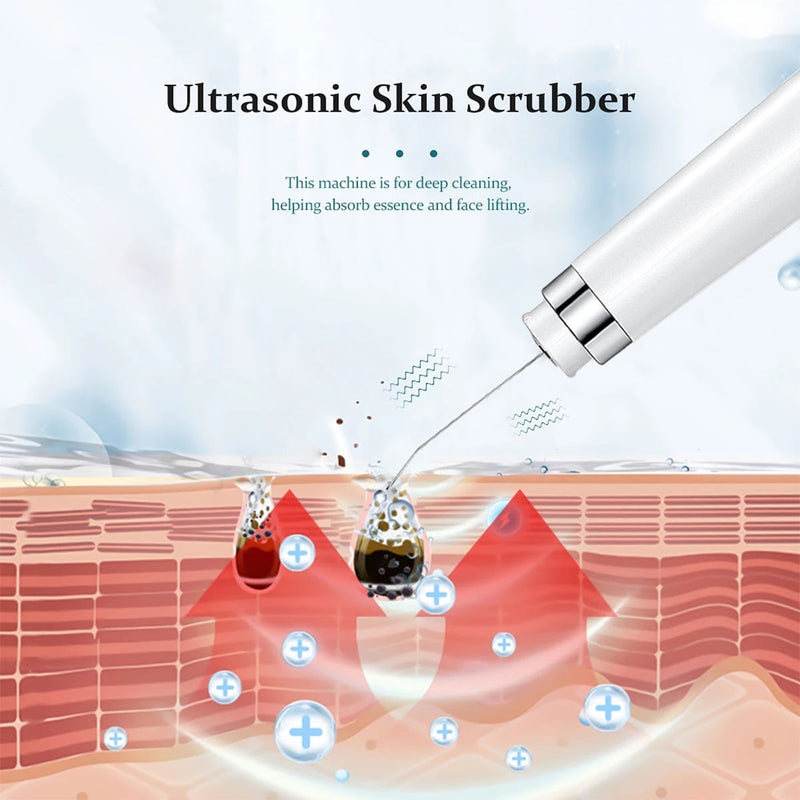 Aparelho Ultrasônico Peeling profundo purificador da pele e poros limpador profundo acne cravo